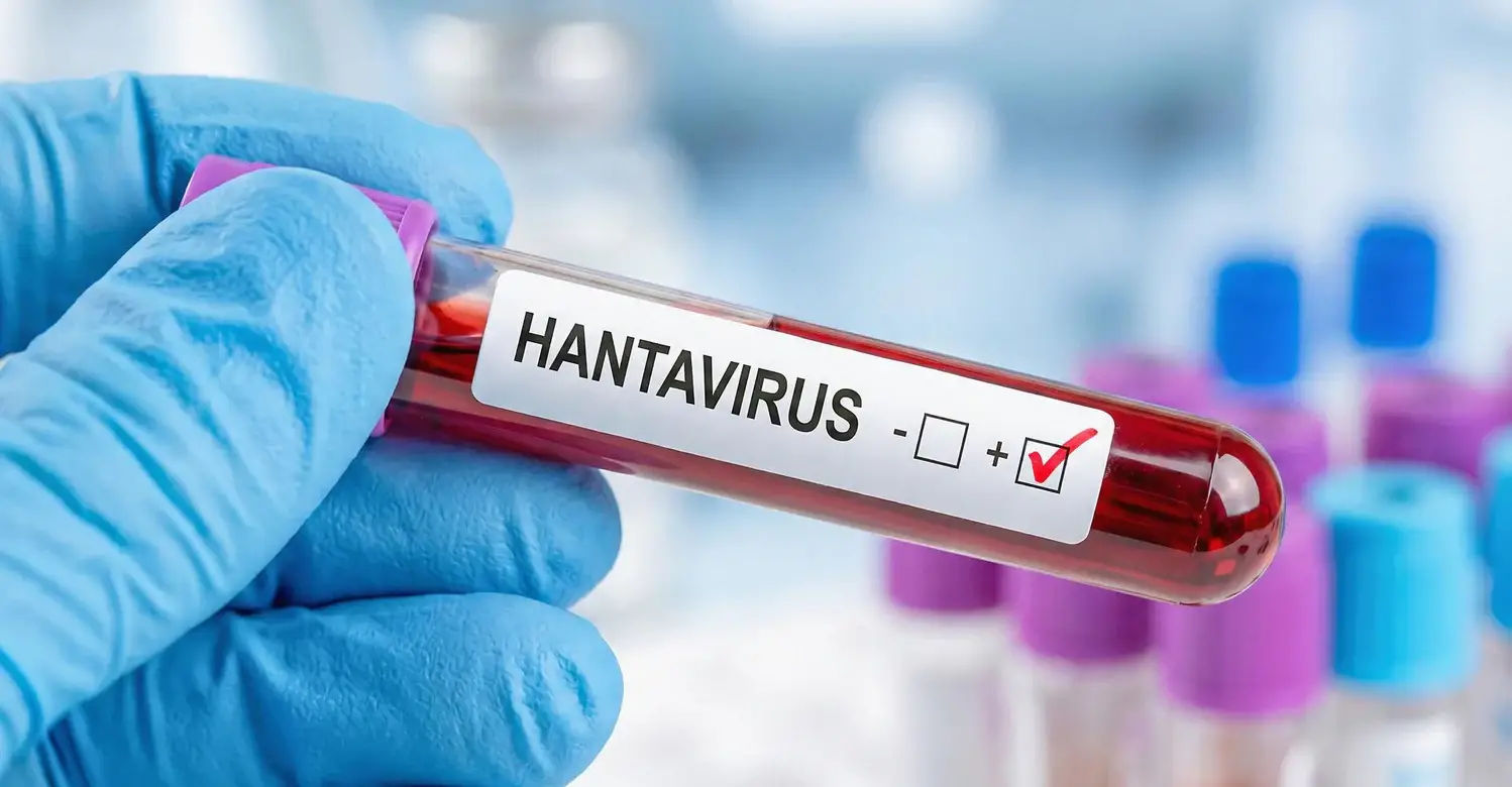 Hantavirus_07b162a9-b23a-4f84-aa8f-893a69baab6a_1498x